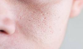 Cách thu nhỏ lỗ chân lông của người Nhật tại nhà