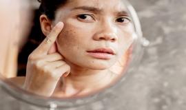 Tìm hiểu viên uống NMN là gì, các loại viên uống NMN, loại nào tốt nhất hiện nay?
