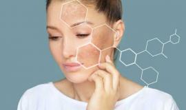 TOP 5 viên uống trị nám tàn nhang tốt nhất của Nhật hiện nay