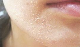 TOP Kem Dưỡng Ẩm Cho Da Khô Của Nhật Đáng Mua Hiện Nay