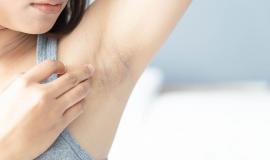 TOP thuốc trị thâm nách của Nhật tốt nhất hiện nay