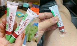 Review Kem trị sẹo Gentacin có tốt không?