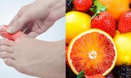 Người bị bệnh Gút kiêng ăn gì tránh bệnh nặng thêm?