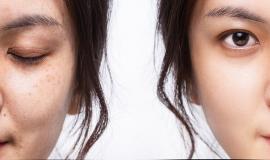 Top Kem Dưỡng Trẻ Hóa Da Của Mỹ Tốt Nhất Hiện Nay Cho Làn Da Trẻ Đẹp Rạng Rỡ