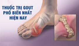 Bị Gút nên uống thuốc gì hiệu quả nhanh nhất?