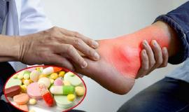 Cách nhận biết thuốc Gút Nhật Bản chính hãng đơn giản và chính xác