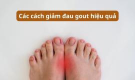 Bật mí các cách giảm đau gout nhanh nhất hiệu quả tức thì