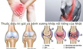 Thuốc điều trị gút và các bệnh xương khớp nổi tiếng của Nhật 