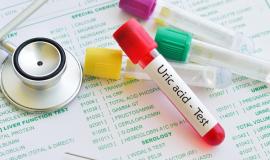 Chỉ số Acid Uric bao nhiêu thì bị Gout?